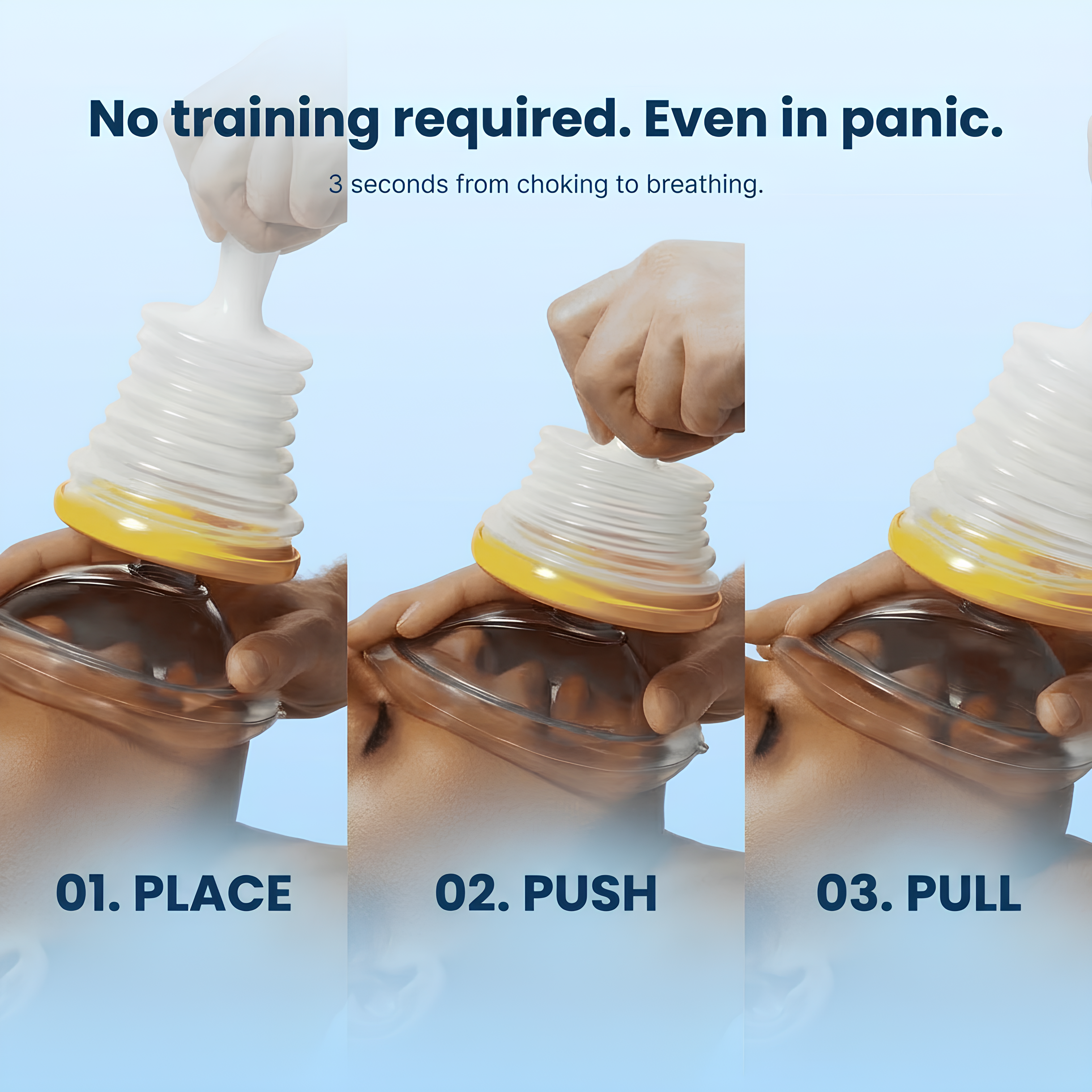 Airvanta™ Emergency Airway Kit